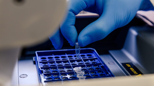 laboratorijska analiza